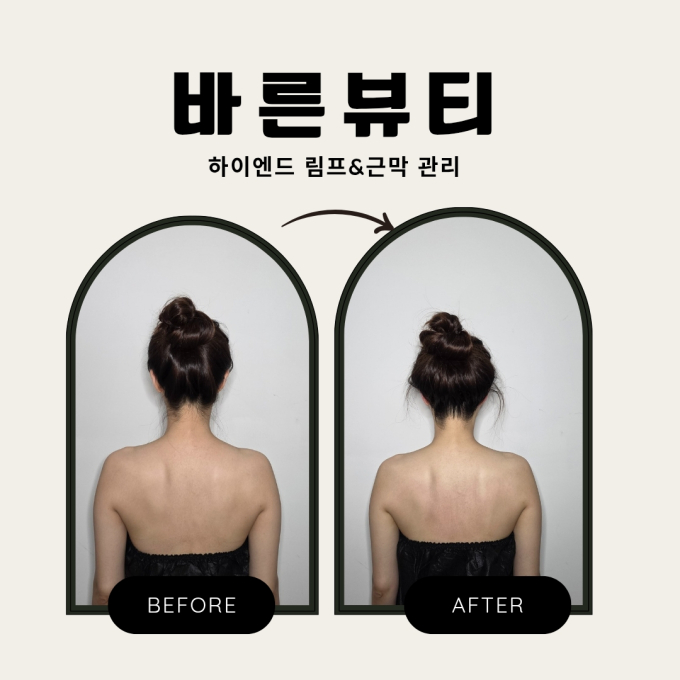 바른뷰티