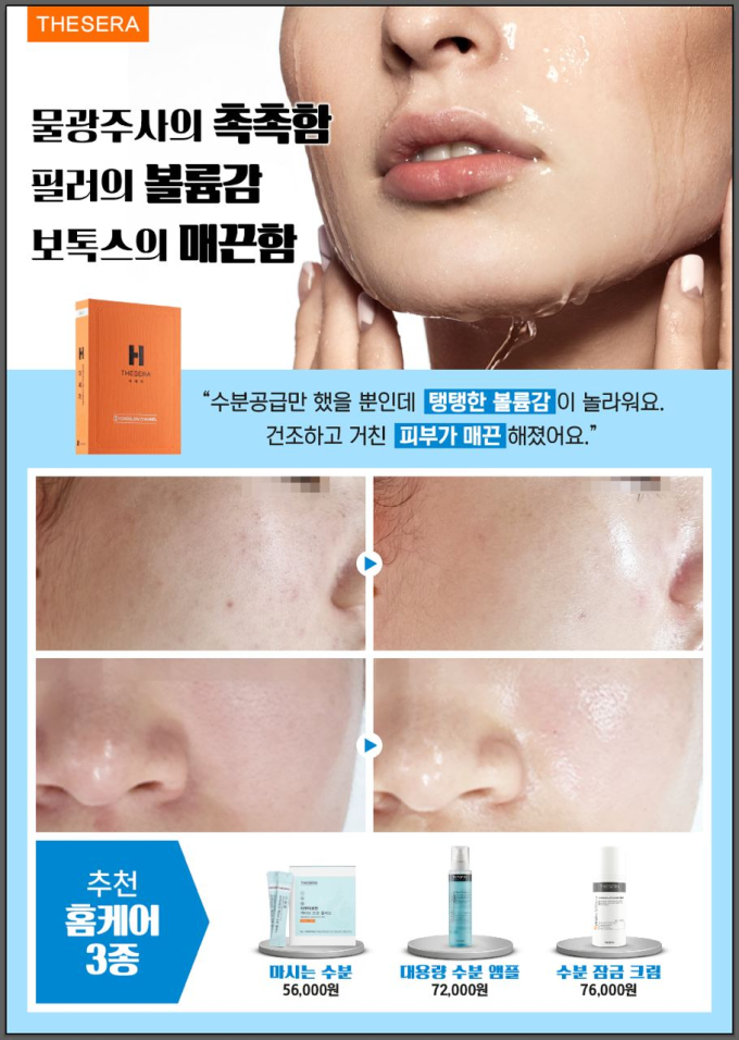 더쎄라