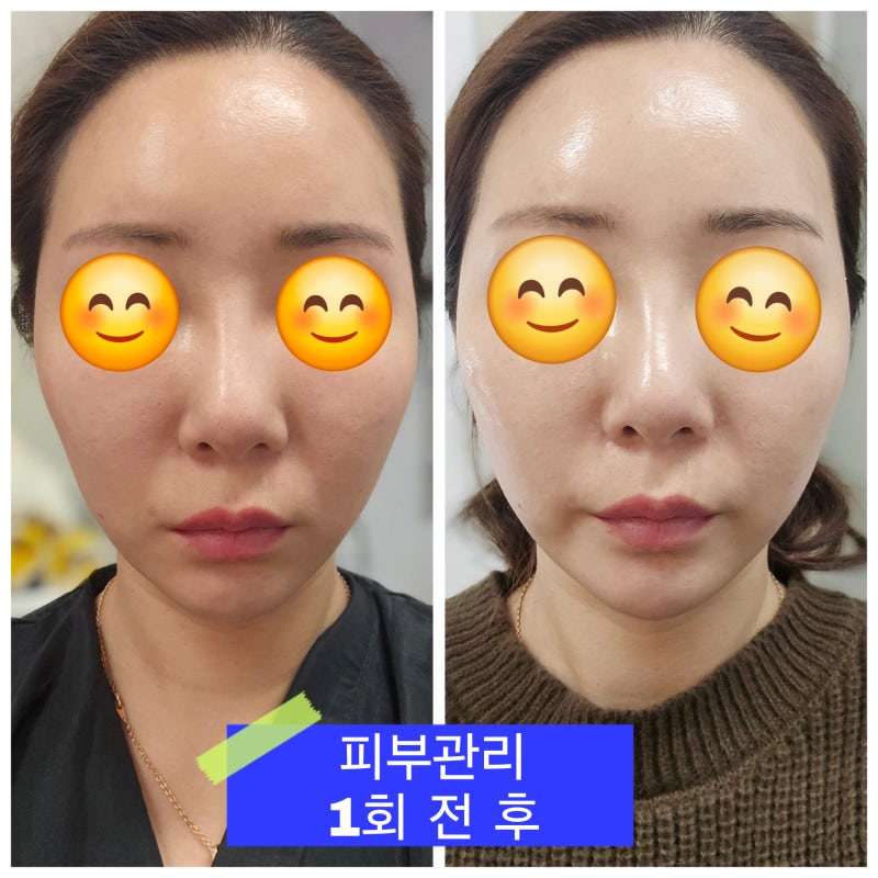 나니뷰티